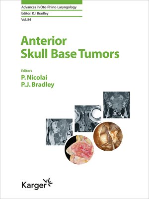 cover image of Anterior Skull Base Tumors
